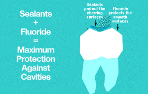 Debra C. Duffy, DDS, PA fluoride and sealants for maximum protection