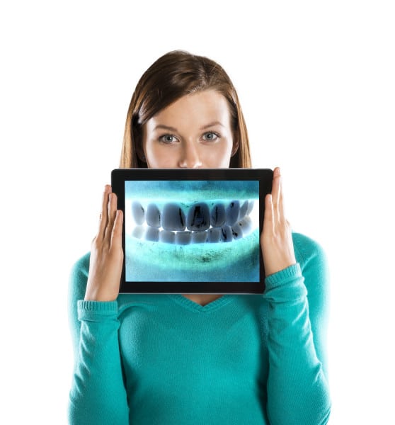 Woman holding tablet with dental x-ray