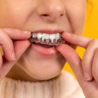 Why You Should Wear a Night Guard for Bruxism